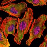 CSK Antibody in Immunocytochemistry (ICC/IF)