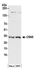 CSN5 Antibody in Western Blot (WB)