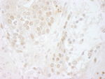 CSN5 Antibody in Immunohistochemistry (IHC)