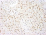 CSN5 Antibody in Immunohistochemistry (IHC)