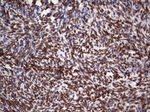 CSNK1E Antibody in Immunohistochemistry (Paraffin) (IHC (P))