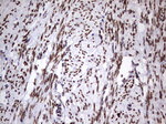 CSNK1E Antibody in Immunohistochemistry (Paraffin) (IHC (P))