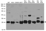 CSNK2B Antibody in Western Blot (WB)