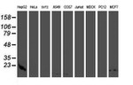 CST3 Antibody in Western Blot (WB)