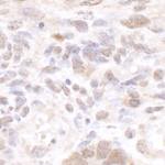 CSTF50 Antibody in Immunohistochemistry (IHC)