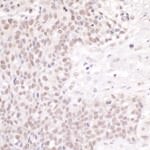 CSTF50 Antibody in Immunohistochemistry (IHC)