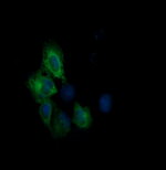 CTAG1B Antibody in Immunocytochemistry (ICC/IF)