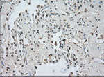 CTAG1B Antibody in Immunohistochemistry (Paraffin) (IHC (P))