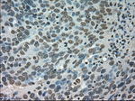 CTAG1B Antibody in Immunohistochemistry (Paraffin) (IHC (P))