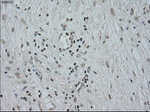 CTAG1B Antibody in Immunohistochemistry (Paraffin) (IHC (P))