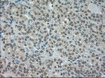 CTAG1B Antibody in Immunohistochemistry (Paraffin) (IHC (P))