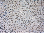 CTAG1B Antibody in Immunohistochemistry (Paraffin) (IHC (P))