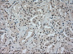 CTAG1B Antibody in Immunohistochemistry (Paraffin) (IHC (P))