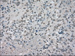 CTAG1B Antibody in Immunohistochemistry (Paraffin) (IHC (P))