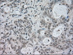 CTAG1B Antibody in Immunohistochemistry (Paraffin) (IHC (P))