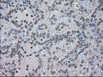 CTAG1B Antibody in Immunohistochemistry (Paraffin) (IHC (P))