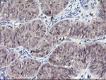 CTAG1B Antibody in Immunohistochemistry (Paraffin) (IHC (P))