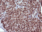 CTAG1B Antibody in Immunohistochemistry (Paraffin) (IHC (P))