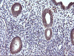 CTAG1B Antibody in Immunohistochemistry (Paraffin) (IHC (P))