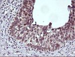 CTAG1B Antibody in Immunohistochemistry (Paraffin) (IHC (P))