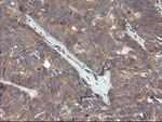 CTAG1B Antibody in Immunohistochemistry (Paraffin) (IHC (P))