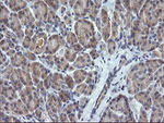 CTAG1B Antibody in Immunohistochemistry (Paraffin) (IHC (P))