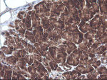 CTAG1B Antibody in Immunohistochemistry (Paraffin) (IHC (P))