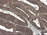 CTAG1B Antibody in Immunohistochemistry (Paraffin) (IHC (P))