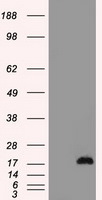 CTAG1B Antibody in Western Blot (WB)