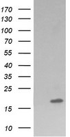 CTAG1B Antibody in Western Blot (WB)