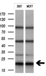 CTAG1B Antibody in Western Blot (WB)