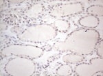 CTBP2 Antibody in Immunohistochemistry (Paraffin) (IHC (P))