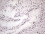 CTBP2 Antibody in Immunohistochemistry (Paraffin) (IHC (P))