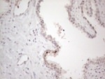 CTBP2 Antibody in Immunohistochemistry (Paraffin) (IHC (P))