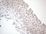 CTBP2 Antibody in Immunohistochemistry (Paraffin) (IHC (P))