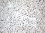 CTBP2 Antibody in Immunohistochemistry (Paraffin) (IHC (P))