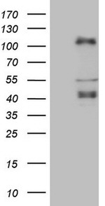 CTBP2 Antibody in Western Blot (WB)
