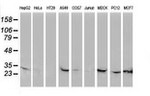 CTDSP1 Antibody in Western Blot (WB)