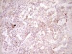 CTGF Antibody in Immunohistochemistry (Paraffin) (IHC (P))