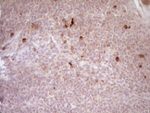 CTGF Antibody in Immunohistochemistry (Paraffin) (IHC (P))