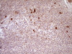 CTGF Antibody in Immunohistochemistry (Paraffin) (IHC (P))