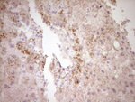 CTGF Antibody in Immunohistochemistry (Paraffin) (IHC (P))