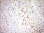 CTGF Antibody in Immunohistochemistry (Paraffin) (IHC (P))