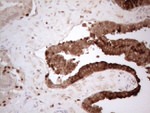 CTGF Antibody in Immunohistochemistry (Paraffin) (IHC (P))