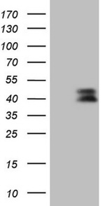 CTGF Antibody in Western Blot (WB)