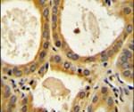 CTLA-4 Antibody in Immunohistochemistry (IHC)