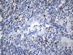 CTLA4 Antibody in Immunohistochemistry (Paraffin) (IHC (P))