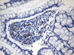 CTLA4 Antibody in Immunohistochemistry (Paraffin) (IHC (P))