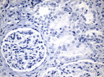 CTLA4 Antibody in Immunohistochemistry (Paraffin) (IHC (P))