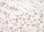 CTNNBL1 Antibody in Immunohistochemistry (IHC)